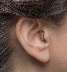 Oreille portant une prothèse auditive placée dans le canal.